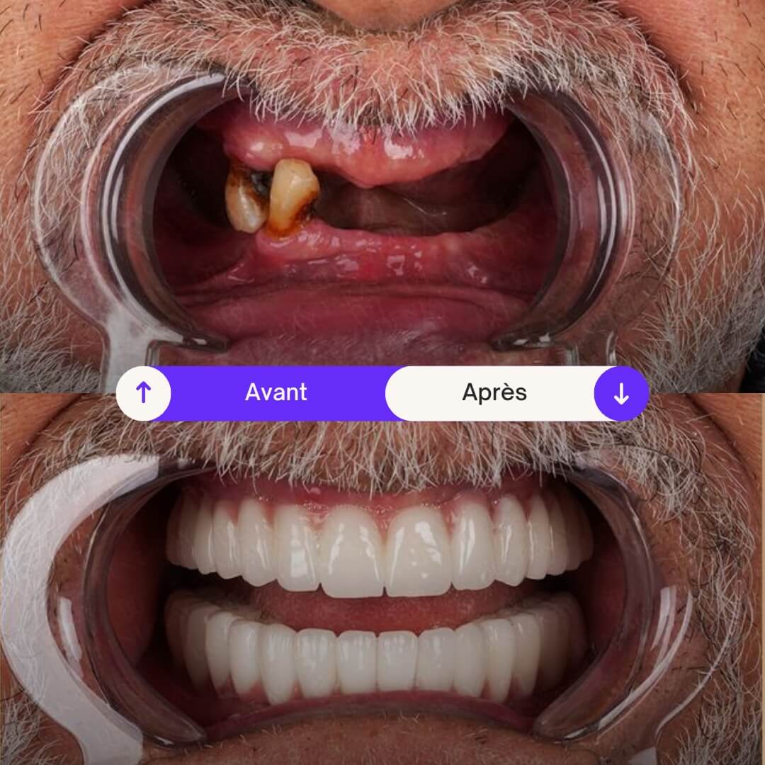 Dentiste dr alaoui ahmed